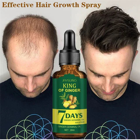 Tónico Spray - ¡Crece el cabello en 7 días! Fortalece el cabello y combate la caída. ¡Aprovecha la oferta!